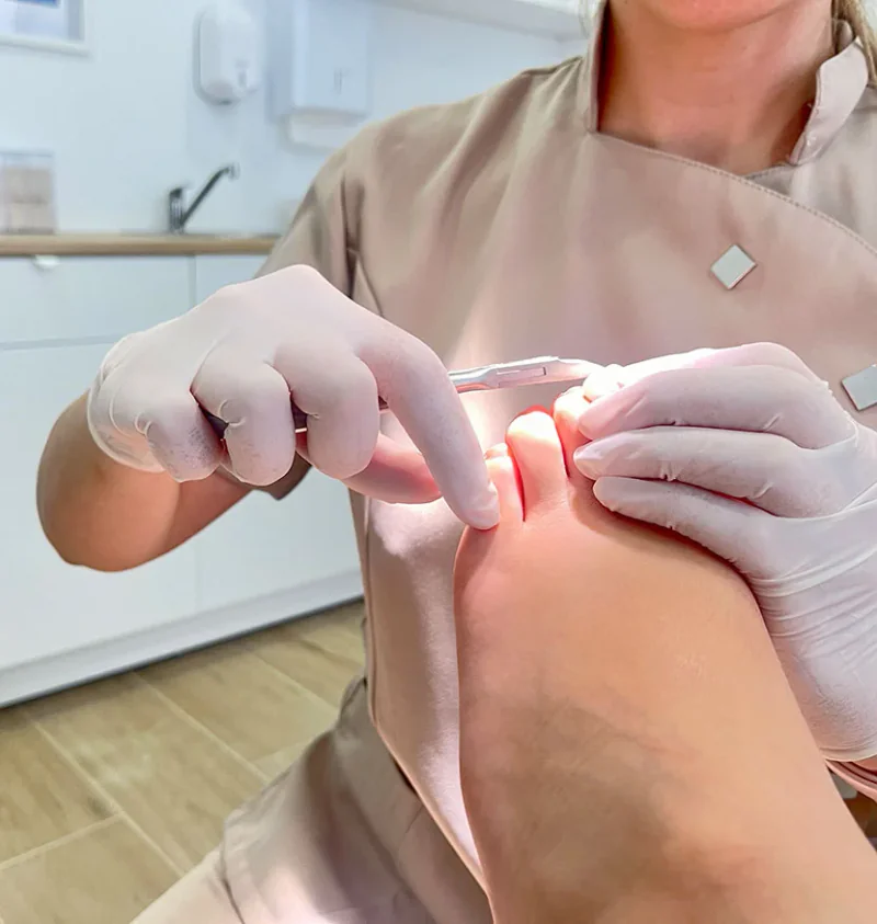 Atención podológica de las uñas de los pies